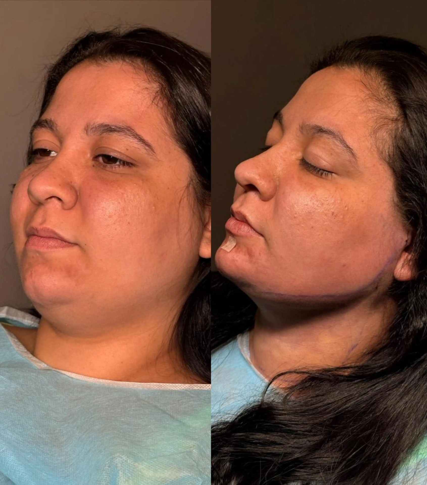 Resultado antes e depois 2