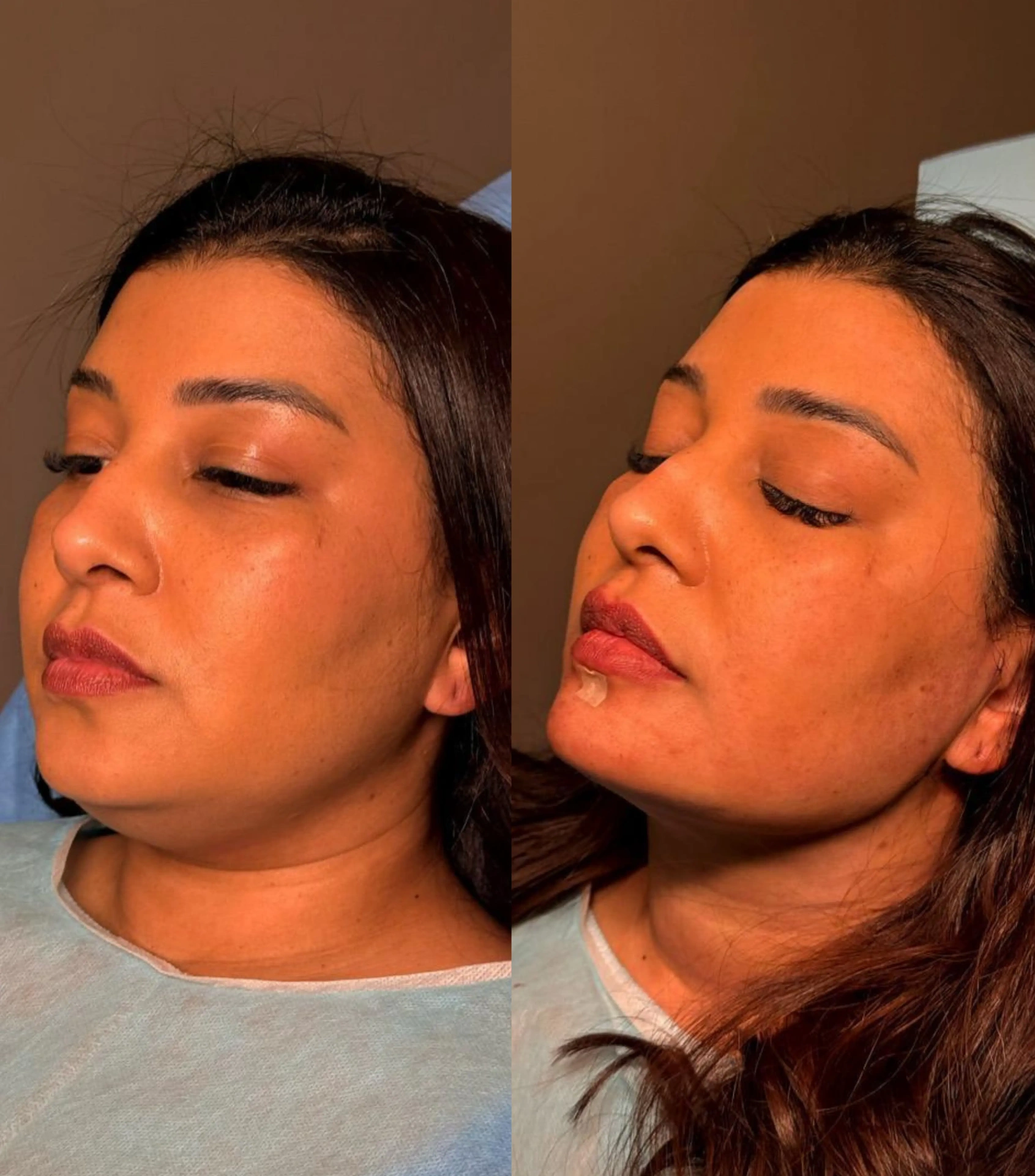 Resultado antes e depois 3