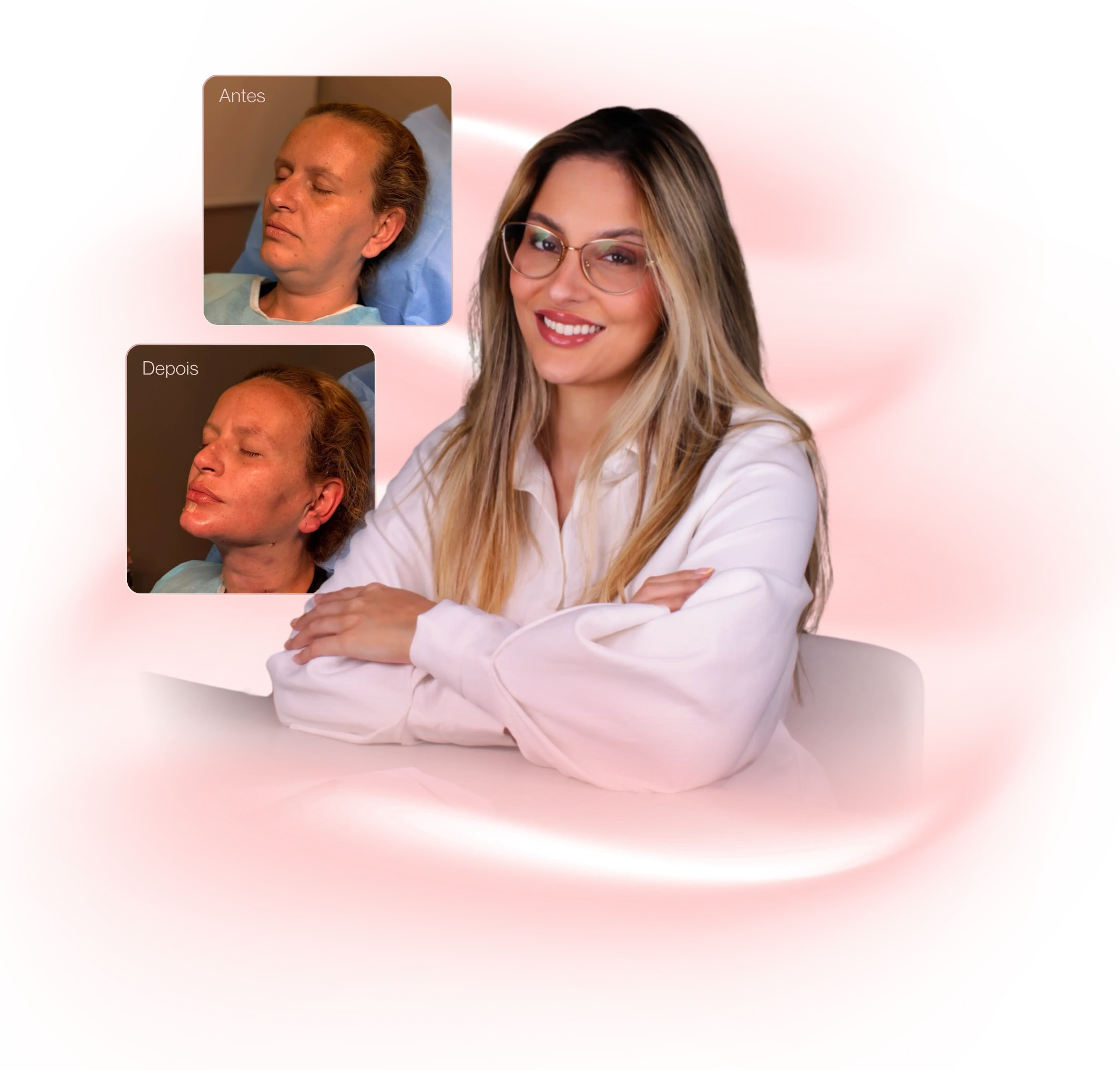Dra. Victória - Resultados de Lipo de Papada antes e depois